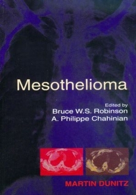 Mesothelioma - 