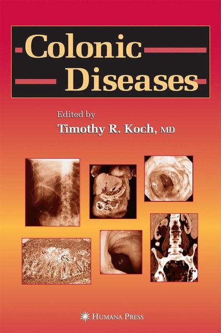 Colonic Diseases - 