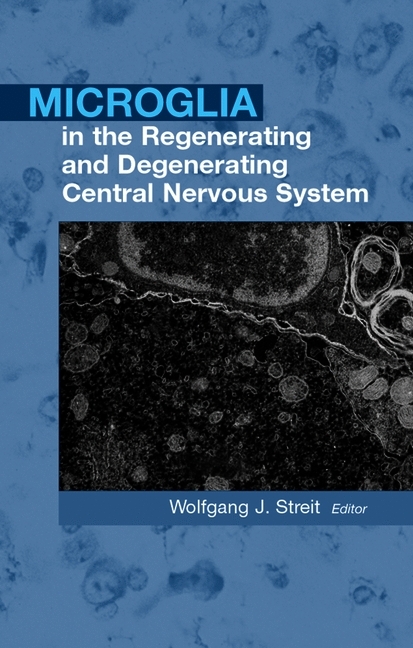 Microglia in the Regenerating and Degenerating Central Nervous System - 