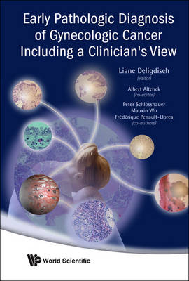 Early Pathologic Diagnosis Of Gynecologic Cancer Including A Clinician's View - Maoxin Wu, Liane Deligdisch, Frederique Penault Llorca, Peter W Schlosshauer, Albert Altchek