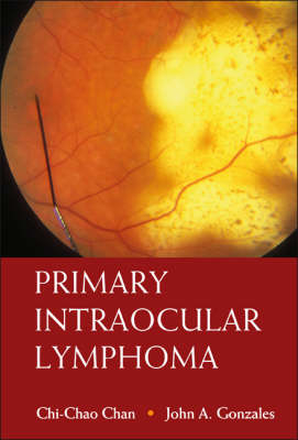 Primary Intraocular Lymphoma - Chi-Chao Chan, John A Gonzales