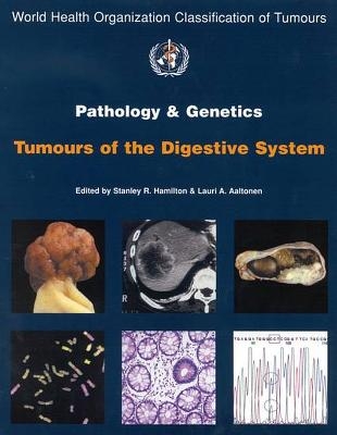 Pathology and Genetics of Tumours of the Digestive System - 