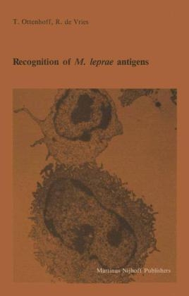 Recognition of M. leprae antigens -  Tom Ottenhoff,  Rene de Vries