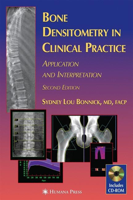 Bone Densitometry in Clinical Practice -  Sydney Lou Bonnick