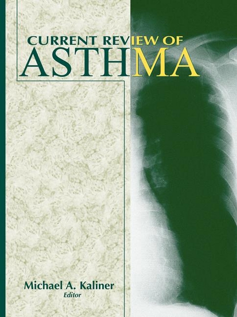 Current Review of Asthma - 