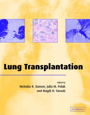 Lung Transplantation - 