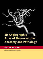 3D Angiographic Atlas of Neurovascular Anatomy and Pathology - Neil M. Borden