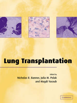 Lung Transplantation - 