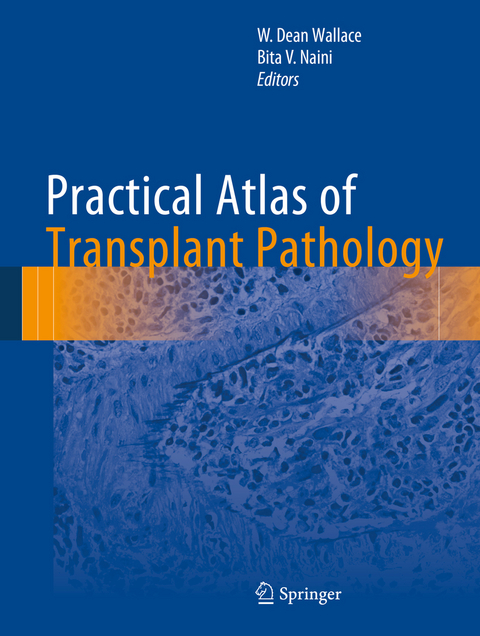 Practical Atlas of Transplant Pathology - 