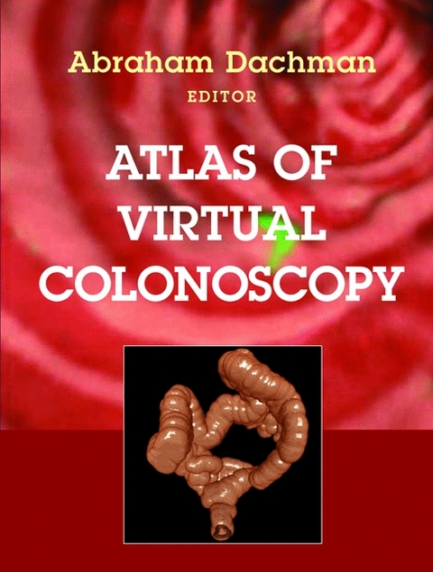 Atlas of Virtual Colonoscopy - 