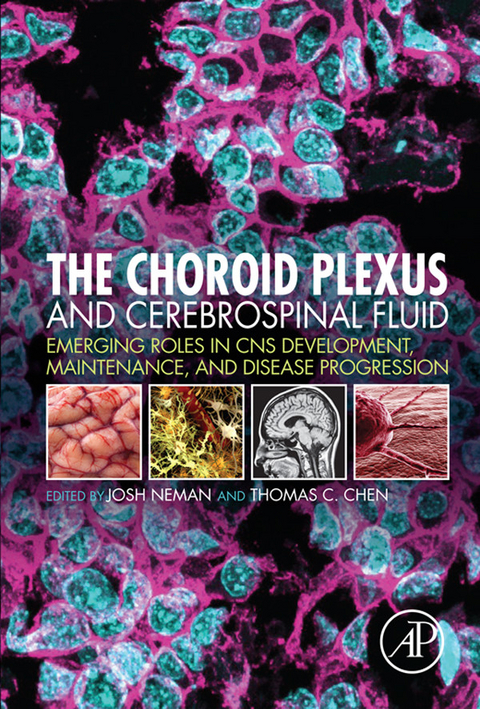 Choroid Plexus and Cerebrospinal Fluid - 