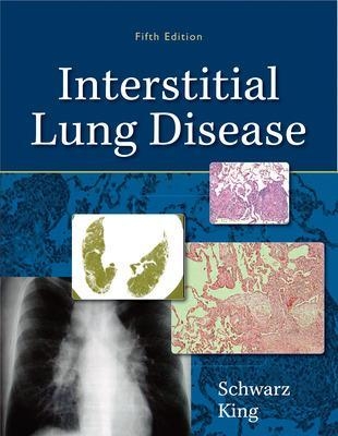 Interstitial Lung Disease - Marvin Schwarz, Talmadge King