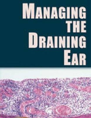 MANAGING THE DRAINING EAR -  DOHAR