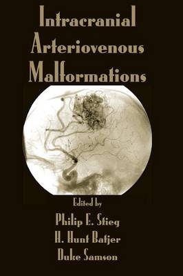 Intracranial Arteriovenous Malformations - 