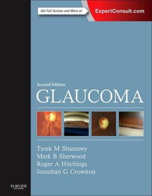 Glaucoma - Tarek M. Shaarawy, Mark B. Sherwood, Roger A. Hitchings, Jonathan G. Crowston