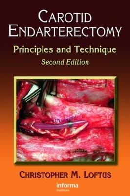 Carotid Endarterectomy - Christopher M. Loftus