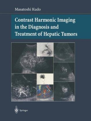 Contrast Harmonic Imaging in the Diagnosis and Treatment of Hepatic Tumors -  Masatoshi Kudo