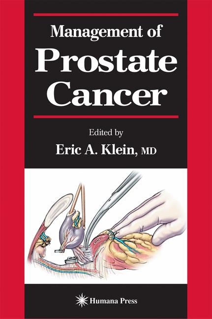 Management of Prostate Cancer - 