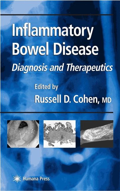 Inflammatory Bowel Disease - 