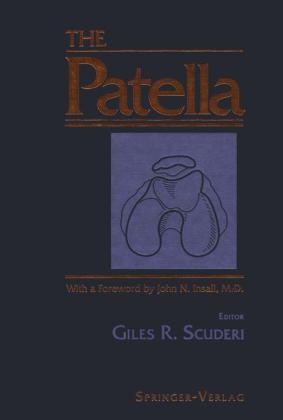 Patella - 