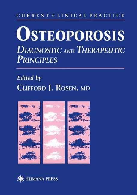 Osteoporosis - 