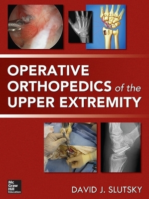 Operative Orthopedics of the Upper Extremity - David Slutsky