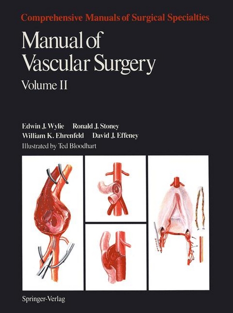 Manual of Vascular Surgery - Edwin J.. Wylie, Ronald J. Stoney, Wiliam K. Ehrenfeld, David J. Effeney