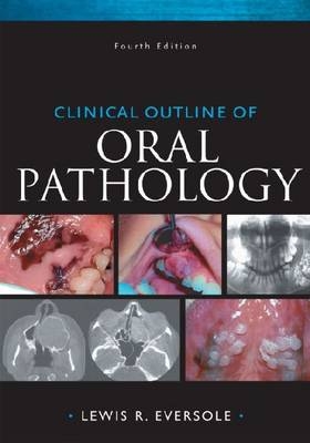 Clinical Outline of Oral Pathology - Lewis Eversole