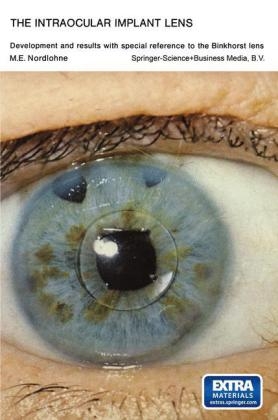 Intraocular Implant Lens Development and Results with Special Reference to the Binkhorst Lens -  Marcel Eugene Nordlohne