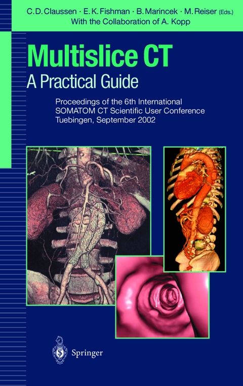 Multislice CT: A Practical Guide - 