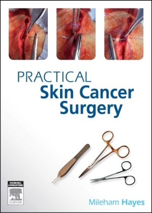 Practical Skin Cancer Surgery - Mileham Hayes