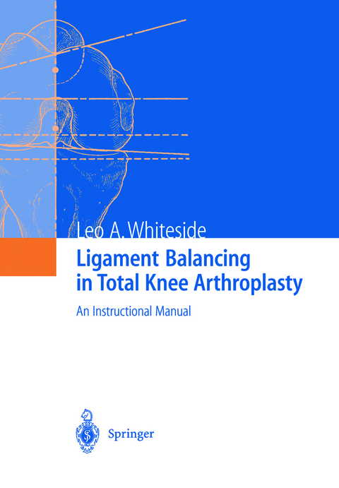 Ligament Balancing in Total Knee Arthroplasty - Leo A. Whiteside