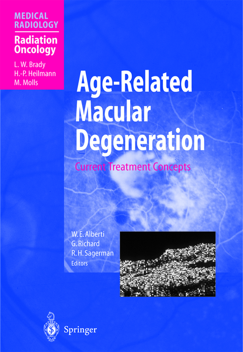 Age-Related Macular Degeneration - 