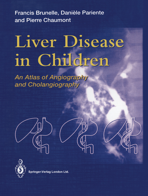 Liver Disease in Children - Francis Brunelle, Daniele Pariente, Pierre Chaumont