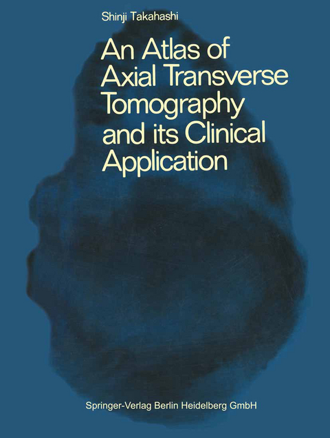 An Atlas of Axial Transverse Tomography and its Clinical Application - A.S. Takahashi