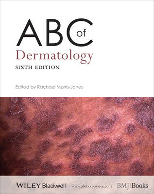 ABC of Dermatology - 