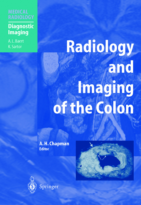 Radiology and Imaging of the Colon - 