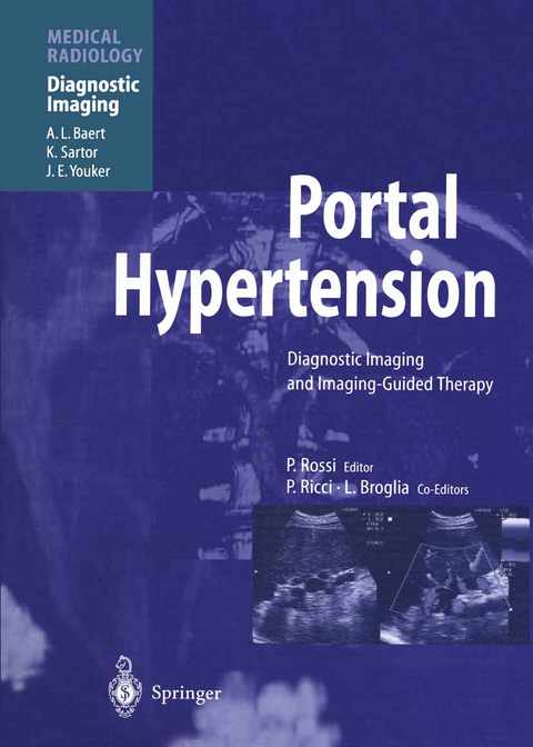 Portal Hypertension - 