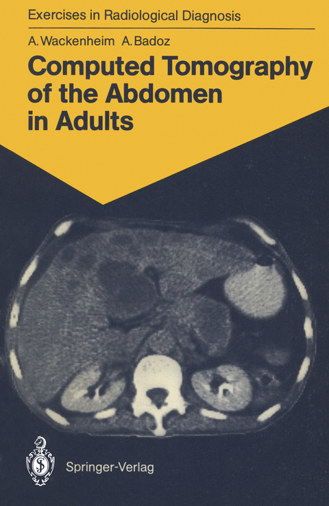 Computed Tomography of the Abdomen in Adults - Auguste Wackenheim, Armelle Badoz