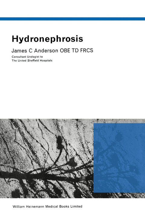 Hydronephrosis -  James C. Anderson