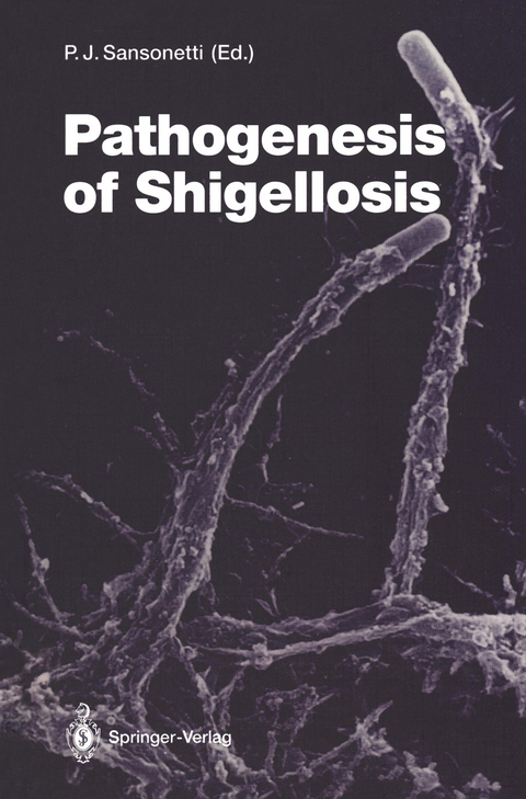 Pathogenesis of Shigellosis - 