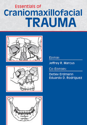 Essentials of Craniomaxillofacial Trauma - 