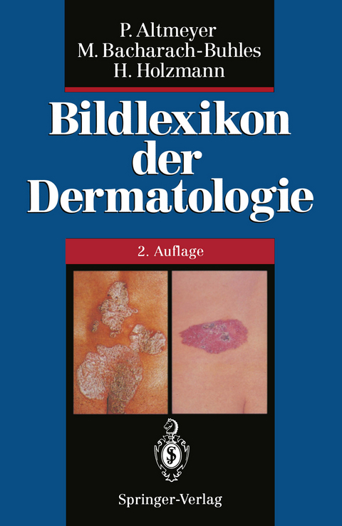 Bildlexikon der Dermatologie - Peter Altmeyer, Martina Bacharach-Buhles, Hans Holzmann