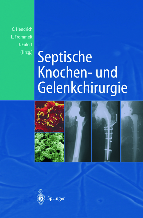 Septische Knochen-und Gelenkchirurgie - 