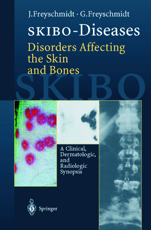 SKIBO-Diseases Disorders Affecting the Skin and Bones - Jürgen Freyschmidt, Gisela Freyschmidt