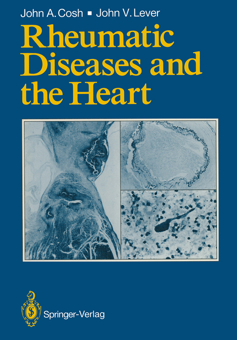 Rheumatic Diseases and the Heart - John A. Cosh, John V. Lever