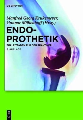 Endoprothetik - 