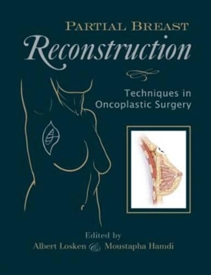 Partial Breast Reconstruction - 