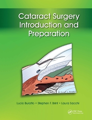 Cataract Surgery - Lucio Buratto, Stephen Brint, Laura Sacchi