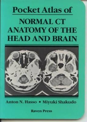 Pocket Atlas of Normal CT Anatomy of the Head and Brain - Anton N. Hasso, Miyuki Shakudo